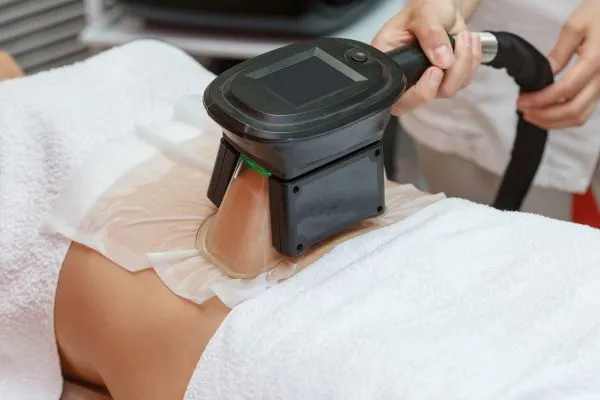 Image of person having fat freezing treatment to help weight gain Tetbury