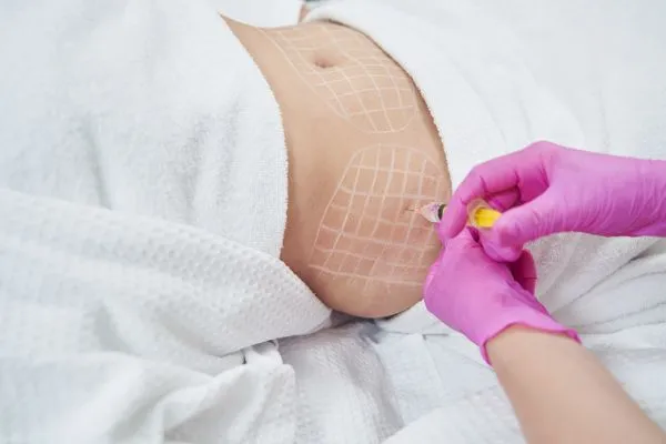 image of fat dissolving injections on love handles to help combat weight gain Tetbury