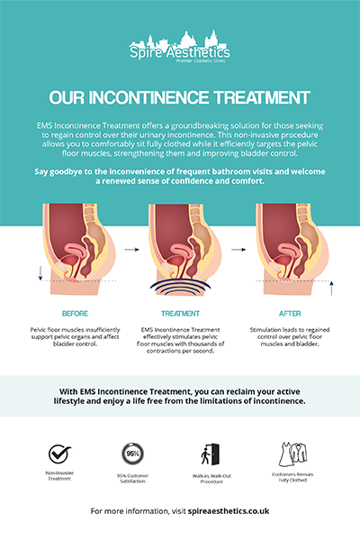 image to show how EMS treatment works for female urinary incontinence Tetbury