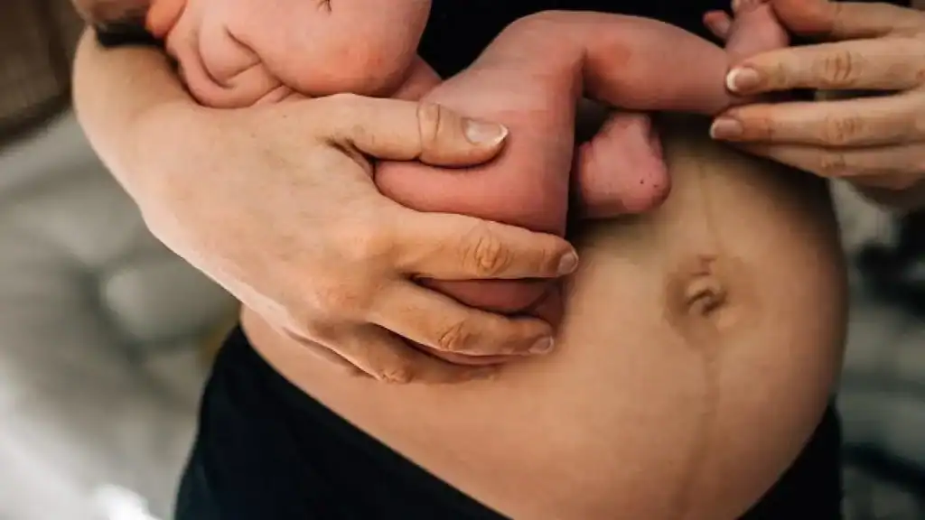 Why Is My Stomach Still Big After Pregnancy Tetbury?