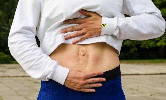 When Could Diastasis Recti Be the Missing Piece of the Puzzle Tetbury?